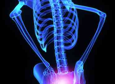 What is Sacroiliac Syndrome / Dysfunction?